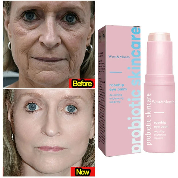 Eye Cream Remove