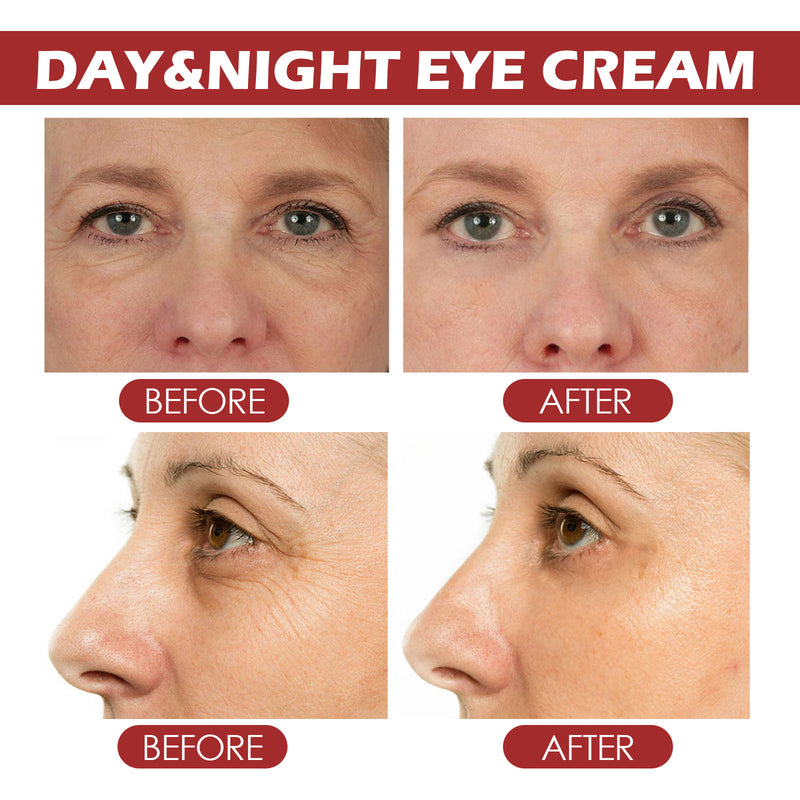 Retinol Eye Cream